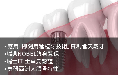 瑞士ITI/瑞士Nobel即刻种植技術